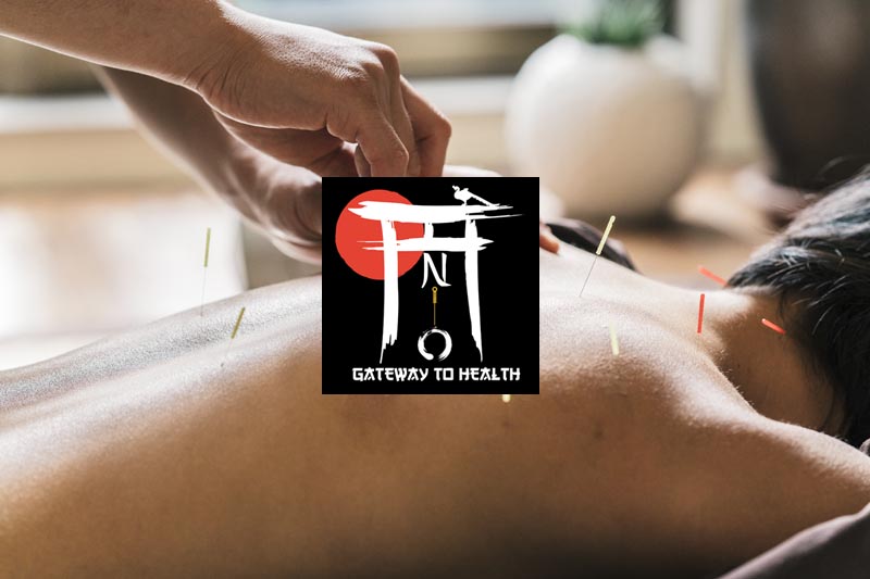 Acupuncture at Beacon Climbing Centre, Caernarfon, North Wales Acupuncture at Beacon Climbing Centre, Caernarfon, North Wales